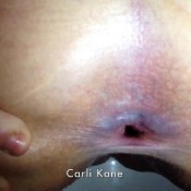 carli kane shows poop via gape, shits it out