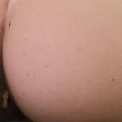 poop recovery a lot of shit! hd badkithy