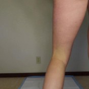 cng poop description. hd gassy classyngassy