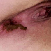 stretch hard shit hd the fart babes