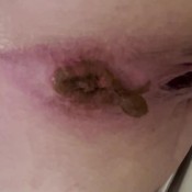 3 poop doses hd The fart babes