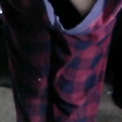 astonishinganatomies - full defecation and urination