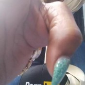 kjuicie poo eruption