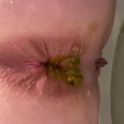 Foxness Pooping A Series _ Episode 11