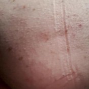 Freckledred_ Parking Lot Shit In A Cup