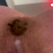 Freckledred Fast Shit