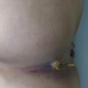 Sarathonson Shitty Dream