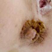 Freckledred_ Shit In A Bucket