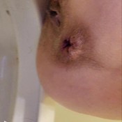 Xxtbearxx Havnt Shit In 8 Days