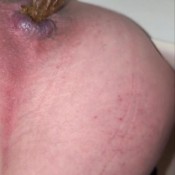 Mala_falda Toilet Mala Falda