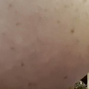 Freckledred_ Giant Shit