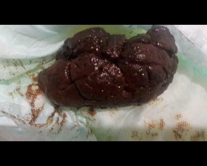 nastyfartpeediaper the fart babes